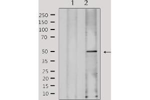 Western blot analysis of extracts from Hela, using FKRP Antibody. (FKRP anticorps  (N-Term))