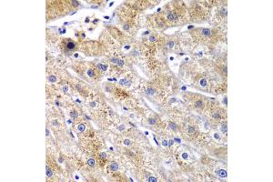 Immunohistochemistry of paraffin-embedded human liver injury using DPP3 antibody (ABIN6292042) at dilution of 1:100 (40x lens). (DPP3 anticorps)