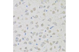 Immunohistochemistry of paraffin-embedded mouse brain using PENK antibody (ABIN6133151, ABIN6145444, ABIN6145445 and ABIN6221906) at dilution of 1:100 (40x lens).