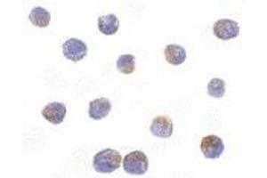 anti-serine/threonine Kinase 17b (STK17B) (C-Term) antibody