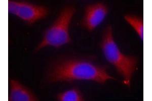 Immunofluorescence staining of methanol-fixed Hela cells using Tau(Phospho-Ser262) Antibody.