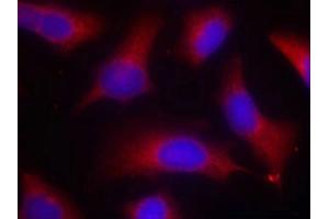 Immunofluorescence staining of methanol-fixed Hela cells using Tau(Phospho-Ser262) Antibody. (MAPT anticorps  (pSer262))