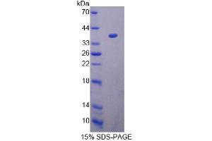 SDS-PAGE analysis of Human ACAT1 Protein. (ACAT1 Protéine)