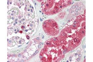 IHC-P Image ENTPD5 antibody [N1N3] detects ENTPD5(CD39L4) protein at cytoplasm on human placenta by immunohistochemical analysis.