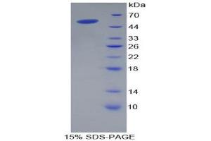SDS-PAGE (SDS) image for Corin, Serine Peptidase (CORIN) (AA 134-573) protein (His tag) (ABIN2124502) (Corin Protein (AA 134-573) (His tag))