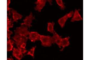 ABIN6272532 staining HuvEc by IF/ICC. (HNF1B anticorps  (Internal Region))