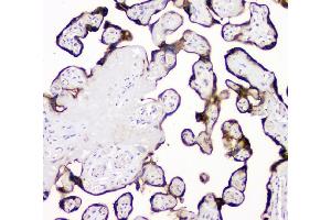 IHC analysis of PLAT using anti-PLAT antibody (ABIN6719378). (PLAT anticorps)