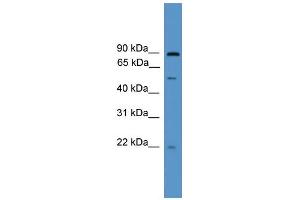WB Suggested Anti-OAZ3 Antibody Titration: 0. (OAZ3 anticorps  (Middle Region))