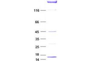 Validation with Western Blot