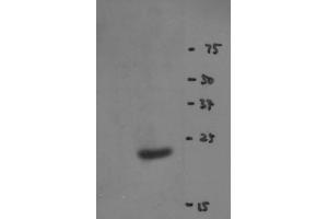 Image no. 2 for anti-RNA Binding Motif Protein 8A (RBM8A) antibody (ABIN108586) (RBM8A anticorps)