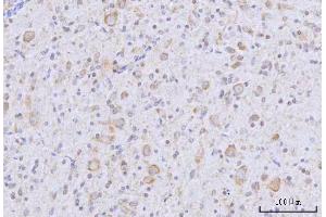 IHC analysis of RARS/RARS1 using anti-RARS/RARS1 antibody (ABIN7600223). (Probable Arginine--tRNA Ligase, Cytoplasmic (RARS-1) (AA 165-425) anticorps)