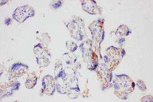 Anti-Galectin 3 Picoband antibody,  IHC(P): Human Placenta Tissue (Galectin 3 anticorps  (AA 139-250))