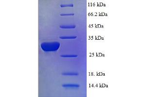 SDS-PAGE (SDS) image for Inhibitor of DNA Binding 2 (Id2) (AA 1-134), (full length) protein (His-SUMO Tag) (ABIN5709695)