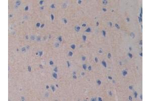IHC-P analysis of Mouse Cerebrum Tissue, with DAB staining. (FDFT1 anticorps  (AA 217-416))
