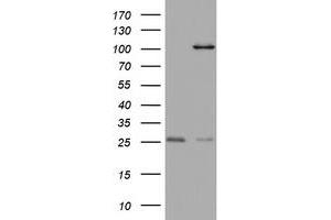 Western Blotting (WB) image for anti-Chromosome 3 Open Reading Frame 15 (C3orf15) (AA 1-313) antibody (ABIN2715591) (C3orf15 anticorps  (AA 1-313))