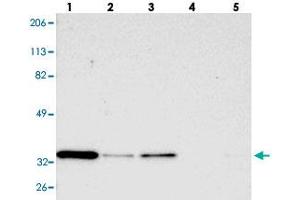 Western blot analysis of Lane 1: RT-4, Lane 2: U-251 MG, Lane 3: A-431, Lane 4: Liver, Lane 5: Tonsil with STX3 polyclonal antibody  at 1:250-1:500 dilution. (STX3 anticorps)