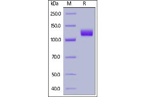 Human PSMA, Fc Tag on  under reducing (R) condition.