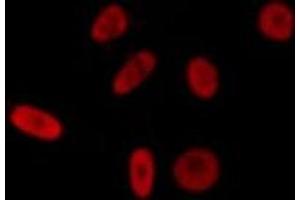 ABIN6275605 staining LOVO by IF/ICC.