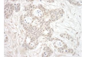 Immunohistochemistry (IHC) image for anti-Origin Recognition Complex, Subunit 3 (ORC3) (AA 325-375) antibody (ABIN7453837)