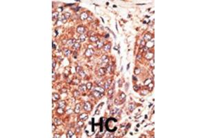 Immunohistochemistry (IHC) image for anti-Septin 9 (SEPT9) antibody (ABIN3002552) (Septin 9 anticorps)