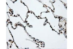 Image no. 11 for anti-Amyloid beta (A4) Precursor Protein (APP) antibody (ABIN1496877) (APP anticorps)