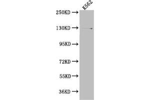 Western Blot Positive WB detected in: K562 whole cell lysate All lanes: HAUSP antibody at 1:1000 Secondary Goat polyclonal to rabbit IgG at 1/50000 dilution Predicted band size: 129, 127 kDa Observed band size: 140 kDa