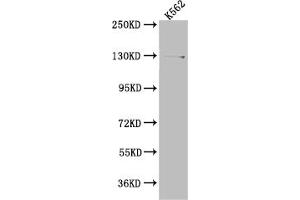 Western Blot Positive WB detected in: K562 whole cell lysate All lanes: HAUSP antibody at 1:1000 Secondary Goat polyclonal to rabbit IgG at 1/50000 dilution Predicted band size: 129, 127 kDa Observed band size: 140 kDa (Recombinant USP7 anticorps)