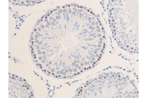 ABIN6267285 at 1/100 staining rat testicular tissue sections by IHC-P. (ErbB2/Her2 anticorps  (pTyr1112))
