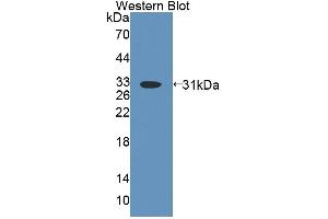 Figure. (ABCD4 anticorps  (AA 356-606))