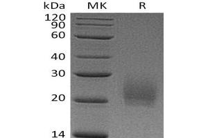 Western Blotting (WB) image for Cytotoxic T-Lymphocyte-Associated Protein 4 (CTLA4) (Active) protein (His tag) (ABIN7320509) (CTLA4 Protein (His tag))