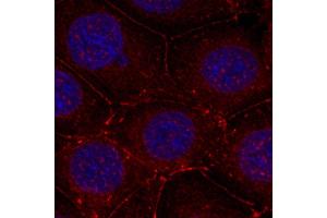 Immunofluorescence staining of methanol-fixed MCF-7 cells using Phospho-IGF1R-Y1161 antibody (ABIN2988064). (IGF1R anticorps  (pTyr1161))