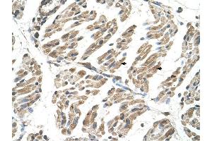 SLC6A8 antibody was used for immunohistochemistry at a concentration of 4-8 ug/ml to stain Skeletal muscle cells (arrows) in Human Muscle. (SLC6A8 anticorps)