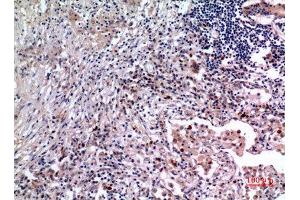 Immunohistochemistry (IHC) analysis of paraffin-embedded Human Lung, antibody was diluted at 1:100. (IL-6 anticorps  (Internal Region))