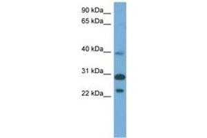 Image no. 1 for anti-Coiled-Coil Domain Containing 28A (CCDC28A) (AA 179-228) antibody (ABIN6745682) (CCDC28A anticorps  (AA 179-228))