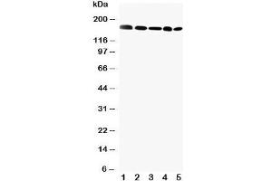Western blot testing of GLI2 antibody and Lane 1: MCF-7;  2: HeLa;  3: SKOV;  4: HT1080;  5: A549 cell lysate.