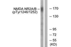 Western Blotting (WB) image for anti-Glutamate Receptor, Ionotropic, N-Methyl D-Aspartate 2A/B (GRIN2A/B) (AA 1216-1265), (pTyr1246) antibody (ABIN482229) (NMDAR2A + 2B anticorps  (pTyr1246))