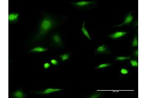 Immunofluorescence of monoclonal antibody to C1D on HeLa cell.