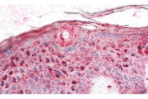 Detection of KLK8 in Human Skin Tissue using Polyclonal Antibody to Kallikrein 8 (KLK8)