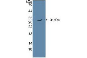 Detection of Recombinant PRKAa2, Human using Polyclonal Antibody to Protein Kinase, AMP Activated Alpha 2 (PRKAa2)
