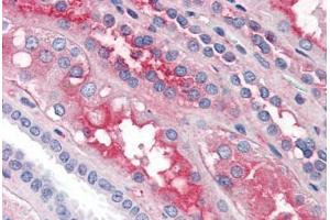 Human Kidney (formalin-fixed, paraffin-embedded) stained with F12 antibody ABIN364435 at 5 ug/ml followed by biotinylated anti-goat IgG secondary antibody ABIN481715, alkaline phosphatase-streptavidin and chromogen.