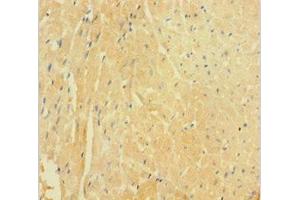 Immunohistochemistry of paraffin-embedded human heart tissue using ABIN7149501 at dilution of 1:100