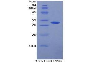 SDS-PAGE analysis of Human FcgRII Protein. (Fc gamma RII (CD32) Protéine)