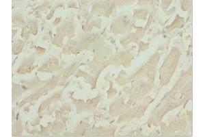 Immunohistochemistry of paraffin-embedded human heart tissue using ABIN7171567 at dilution of 1:100 (TBPL1 anticorps  (AA 1-186))