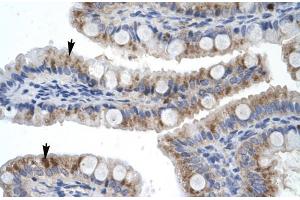 Human Intestine; Rabbit Anti-ZNF341 Antibody. (ZNF341 anticorps  (Middle Region))