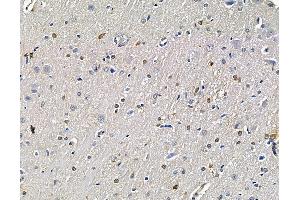 ABIN7096434 and ABIN7100498 at 1/100 staining rat brain tissue by IHC-P. (KLF3 anticorps)