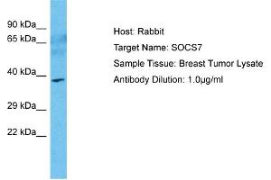 Host: Rabbit Target Name: SOCS7 Sample Type: Breast Tumor lysates Antibody Dilution: 1. (SOCS7 anticorps  (N-Term))