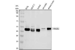 Western blot analysis of IKB beta using anti-IKB beta antibody (ABIN3043567). (NFKBIB anticorps  (AA 56-237))