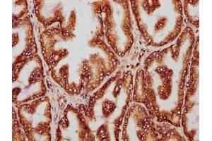 IHC image of ABIN7142103 diluted at 1:221 and staining in paraffin-embedded human prostate tissue performed on a Leica BondTM system.