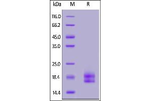 Human PD-L1 (19-134), His Tag on  under reducing (R) condition. (PD-L1 Protein (AA 19-134) (His tag))