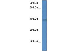 WB Suggested Anti-Slc25a27 Antibody   Titration: 1. (SLC25A27 anticorps  (C-Term))